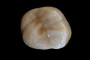 Vivitar Auto Macro 55mm f/2.8 - Occlusal Surface Demo Model